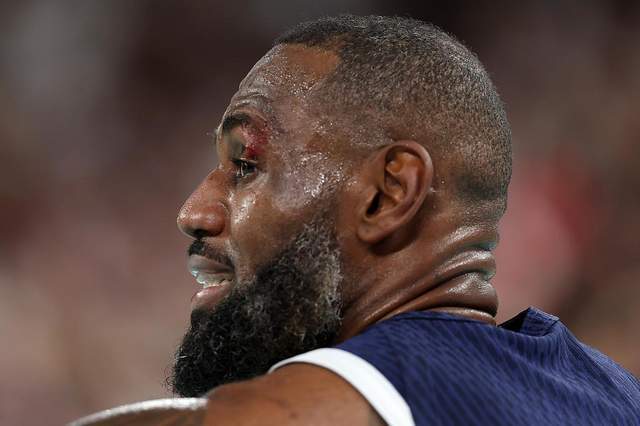 古巴拳击队员激烈对抗，成功晋级半决赛